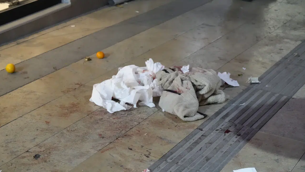 Gümüşhane’de boşanma aşamasındaki eşi tarafından bıçaklanan kadın hastaneye kaldırıldı